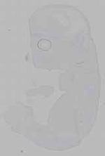 EMAGE:15166