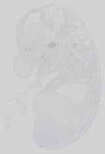 EMAGE:15169