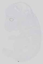 EMAGE:15172
