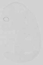 EMAGE:15176