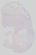 EMAGE:15176
