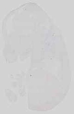 EMAGE:15176