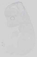 EMAGE:15176