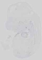 EMAGE:15188
