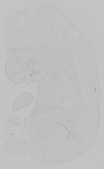 EMAGE:15197
