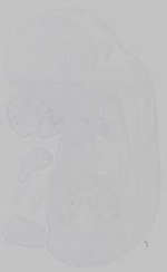 EMAGE:15197