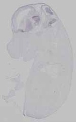 EMAGE:15203