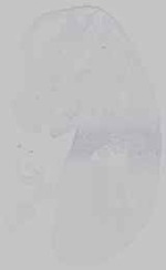 EMAGE:15204
