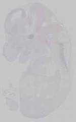 EMAGE:15206