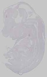 EMAGE:15207