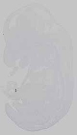EMAGE:15211