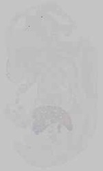 EMAGE:15215