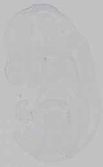 EMAGE:15221