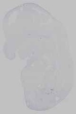 EMAGE:15225