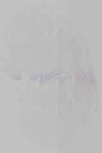 EMAGE:15225