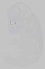 EMAGE:15241