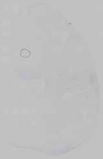 EMAGE:15242