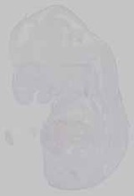 EMAGE:15243