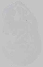 EMAGE:15244