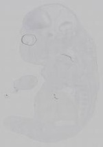 EMAGE:15249
