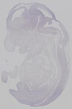EMAGE:15249