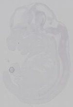 EMAGE:15249