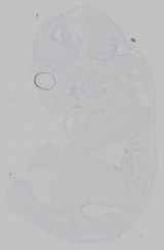 EMAGE:15268