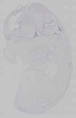 EMAGE:15309