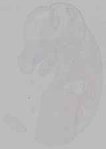 EMAGE:15315
