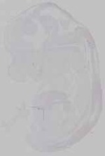 EMAGE:15317