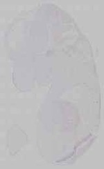 EMAGE:15317