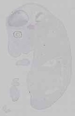 EMAGE:15318