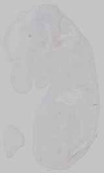 EMAGE:15320