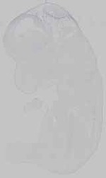 EMAGE:15320