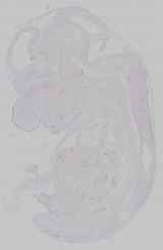 EMAGE:15322