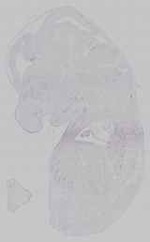 EMAGE:15322