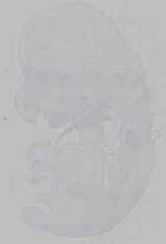 EMAGE:15334
