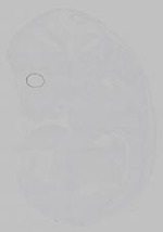 EMAGE:15361