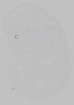 EMAGE:15361