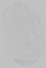 EMAGE:15361
