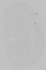 EMAGE:15361