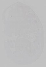 EMAGE:15361