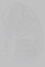 EMAGE:15361