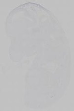 EMAGE:15361