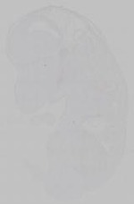 EMAGE:15361