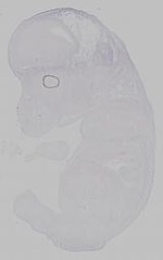 EMAGE:15361