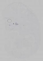 EMAGE:15364