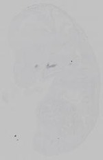EMAGE:15364