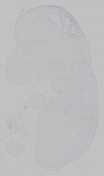 EMAGE:15372