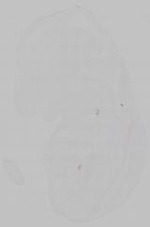 EMAGE:15373